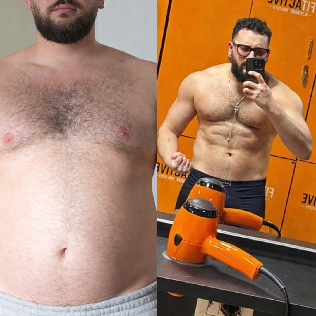 prima e dopo gp 5